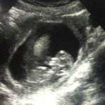 Wanna know where I’ve been?